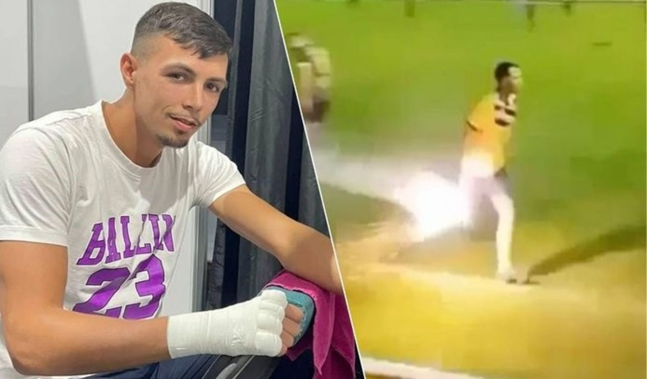 Фабио Скафино неудачно подобрал петарду Фабио Скафино неудачно подобрал петарду