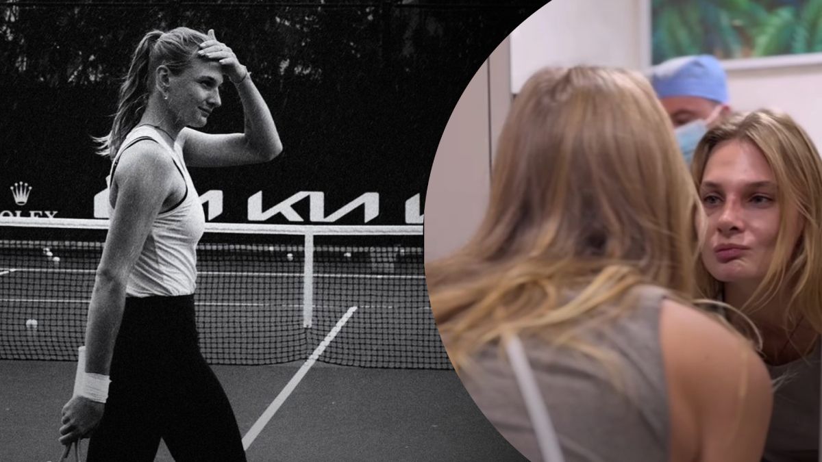 Даяна Ястремська зробила операцію на носі - деталі хірургічного втручання Даяна Ястремська зробила операцію на носі - деталі хірургічного втручання