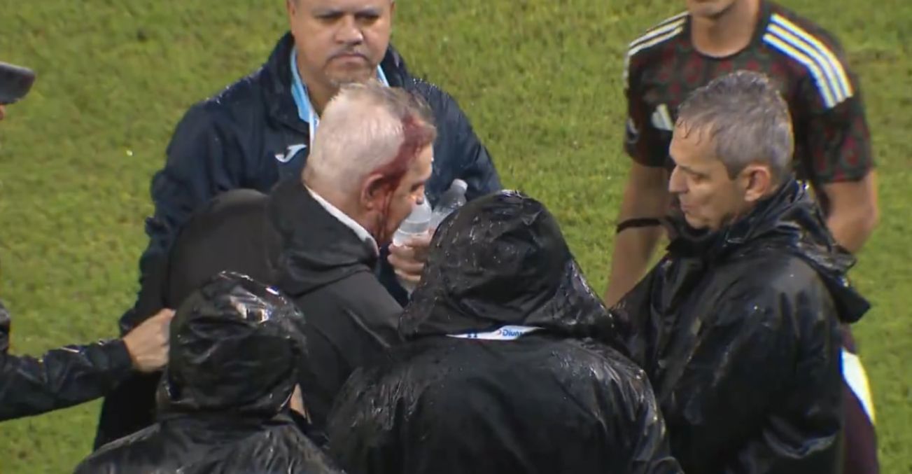 Головний тренер збірної Мексики Хав'єр Агірре отримав банкою пива по голові Головний тренер збірної Мексики Хав'єр Агірре отримав банкою пива по голові