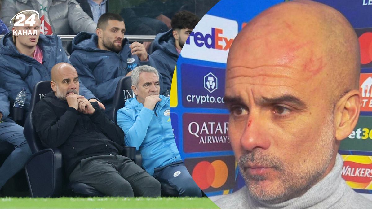 Пеп Гвардиола разодрал себе голову во время матча МанСити –Фейенорд в Лиге чемпионов Пеп Гвардиола разодрал себе голову во время матча МанСити –Фейенорд в Лиге чемпионов