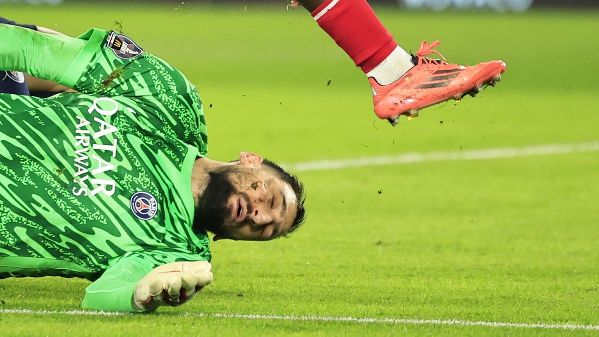 Доннарумма отримав жахливу травму Доннарумма отримав жахливу травму