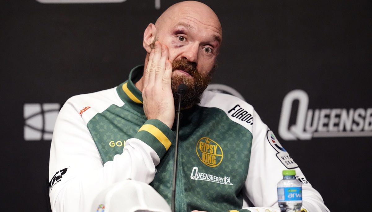 Как выглядит лицо Фьюри после поражения от Усика в реванше Как выглядит лицо Фьюри после поражения от Усика в реванше